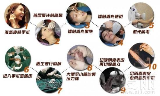 《泰囧》人妖rose揭秘变性整形手术过程(图)(2