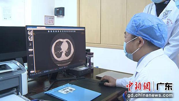 珠海市中西医结合医院专家吴小勤：肺癌需早发现早治疗